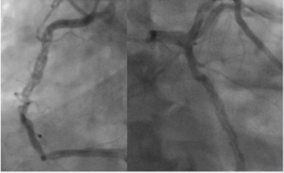 biomedres-openaccess-journal-bjstr