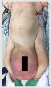biomedres-openaccess-journal-bjstr