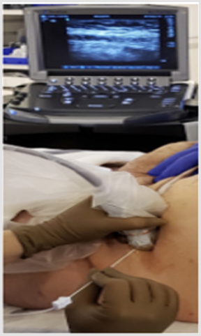 biomedres-openaccess-journal-bjstr