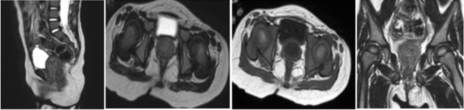 biomedres-openaccess-journal-bjstr