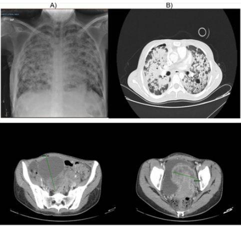 biomedres-openaccess-journal-bjstr