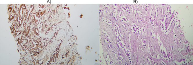 biomedres-openaccess-journal-bjstr