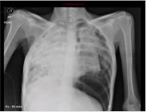 biomedres-openaccess-journal-bjstr