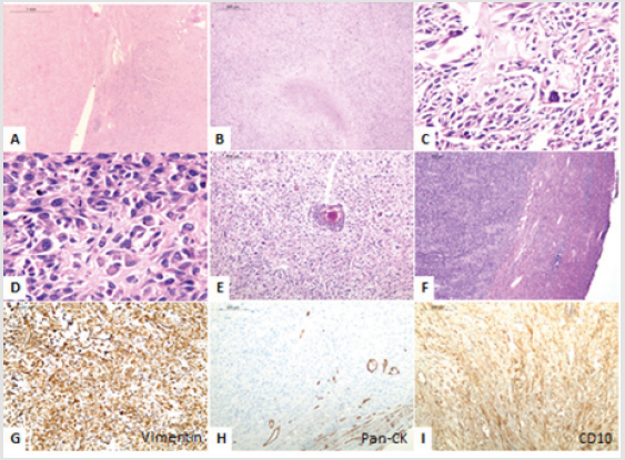 biomedres-openaccess-journal-bjstr