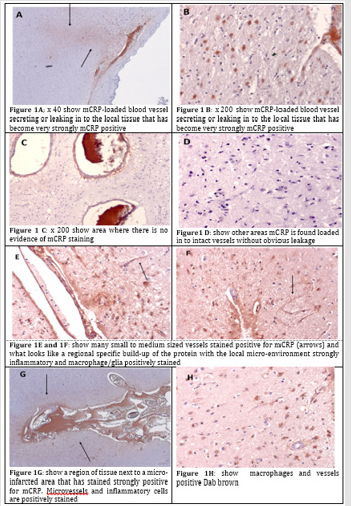 biomedres-openaccess-journal-bjstr