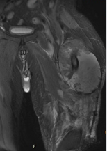 biomedres-openaccess-journal-bjstr