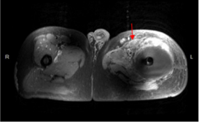 biomedres-openaccess-journal-bjstr