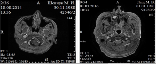 biomedres-openaccess-journal-bjstr