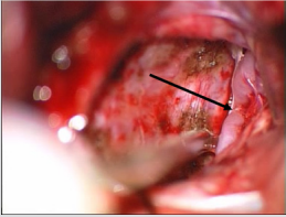 biomedres-openaccess-journal-bjstr