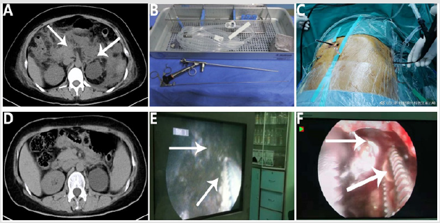 biomedres-openaccess-journal-bjstr