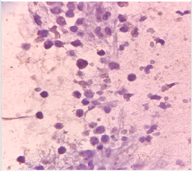 biomedres-openaccess-journal-bjstr
