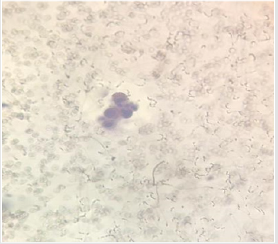 biomedres-openaccess-journal-bjstr