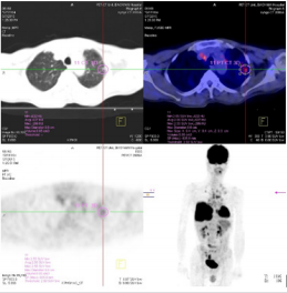 biomedres-openaccess-journal-bjstr