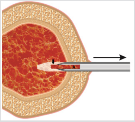 biomedres-openaccess-journal-bjstr