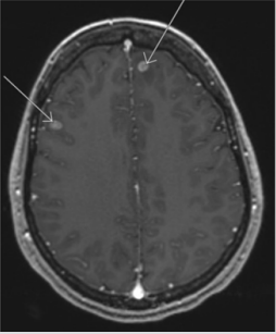 biomedres-openaccess-journal-bjstr