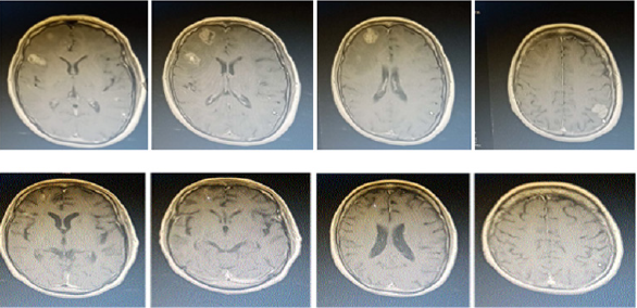 biomedres-openaccess-journal-bjstr
