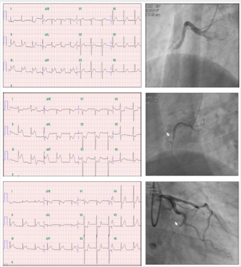 biomedres-openaccess-journal-bjstr