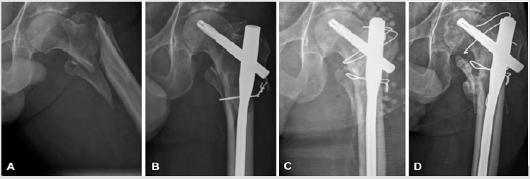 biomedres-openaccess-journal-bjstr