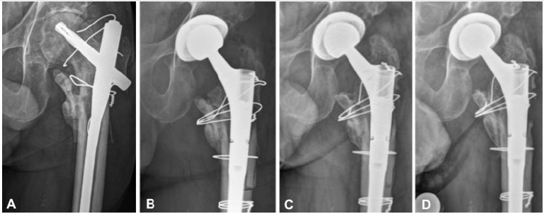 biomedres-openaccess-journal-bjstr