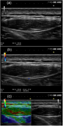 biomedres-openaccess-journal-bjstr