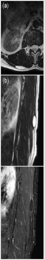 biomedres-openaccess-journal-bjstr