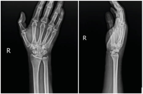biomedres-openaccess-journal-bjstr