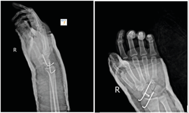 biomedres-openaccess-journal-bjstr