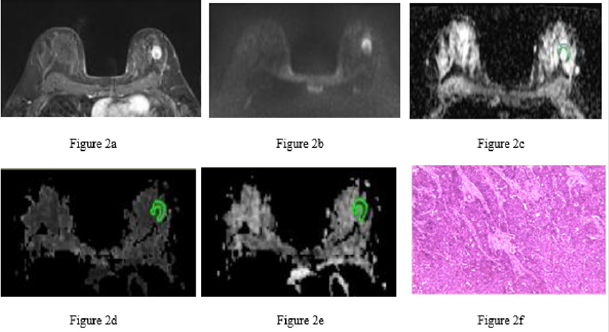 biomedres-openaccess-journal-bjstr