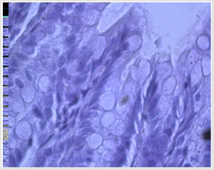 biomedres-openaccess-journal-bjstr