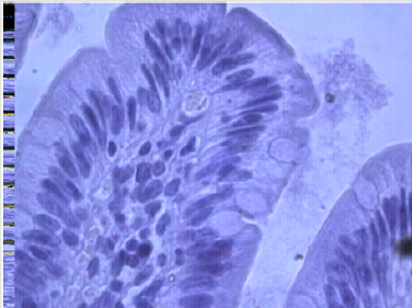 biomedres-openaccess-journal-bjstr
