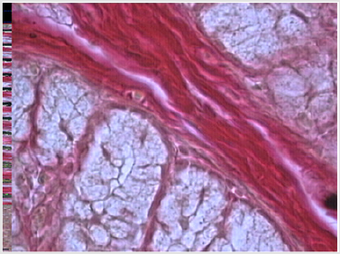 biomedres-openaccess-journal-bjstr
