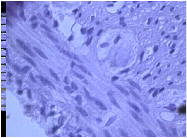 biomedres-openaccess-journal-bjstr