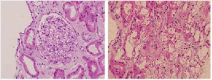 biomedres-openaccess-journal-bjstr