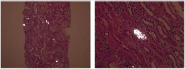 biomedres-openaccess-journal-bjstr