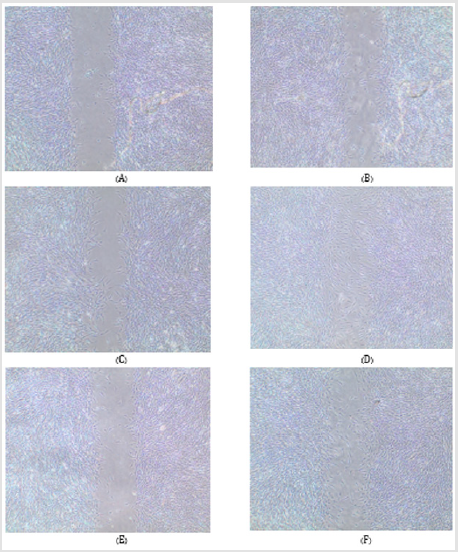 biomedres-openaccess-journal-bjstr