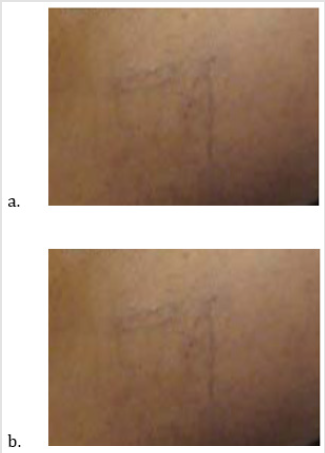 biomedres-openaccess-journal-bjstr