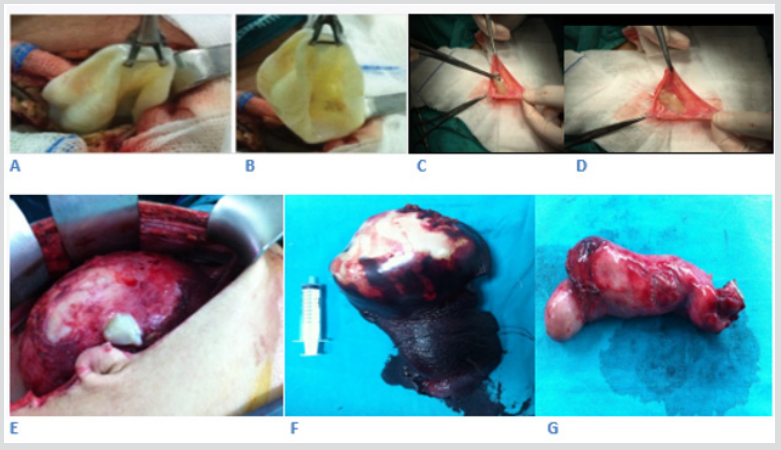 biomedres-openaccess-journal-bjstr