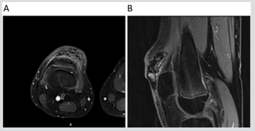 biomedres-openaccess-journal-bjstr