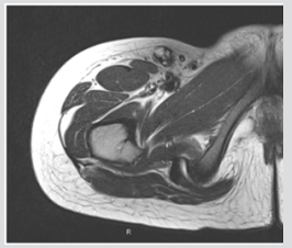 biomedres-openaccess-journal-bjstr