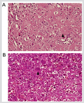 biomedres-openaccess-journal-bjstr