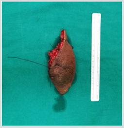 biomedres-openaccess-journal-bjstr