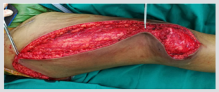 biomedres-openaccess-journal-bjstr
