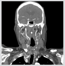 biomedres-openaccess-journal-bjstr