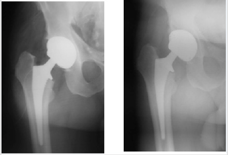 biomedres-openaccess-journal-bjstr