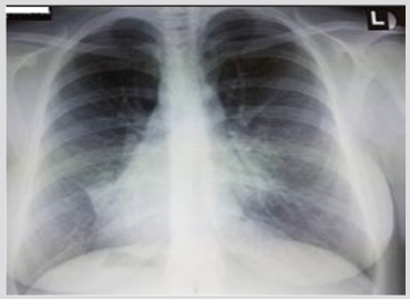 biomedres-openaccess-journal-bjstr