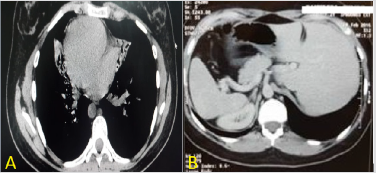 biomedres-openaccess-journal-bjstr
