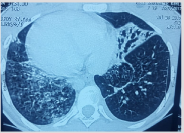 biomedres-openaccess-journal-bjstr