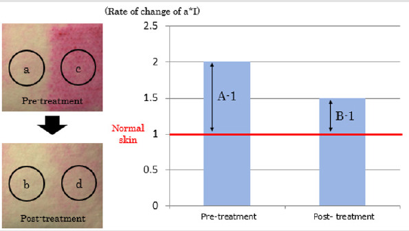 biomedres-openaccess-journal-bjstr
