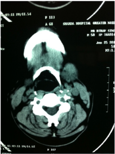biomedres-openaccess-journal-bjstr