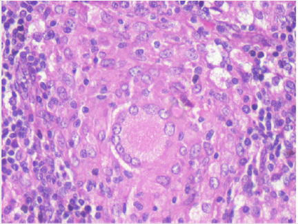 biomedres-openaccess-journal-bjstr